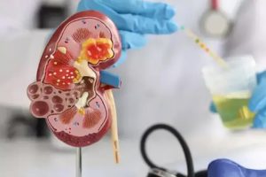 Adrenelektomi (Böbrek Üstü Bezi Tümörleri Cerrahisi)